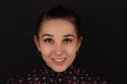 Лицо(после)