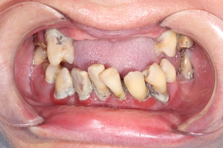 Результат работы(до)