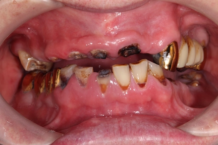 Результат работы(до)