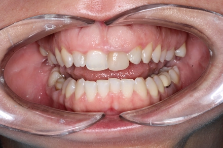 Результат работы(до)