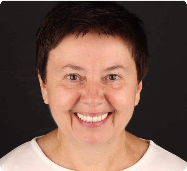 Пациент Ирина | Стоматология в Томске | INTELLY | Эликсир Премьер