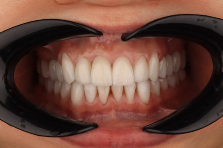 Результат работы(после)