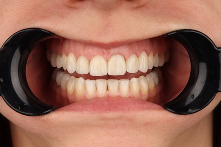 Результат работы(после)