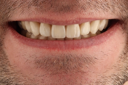 Результат работы(после)