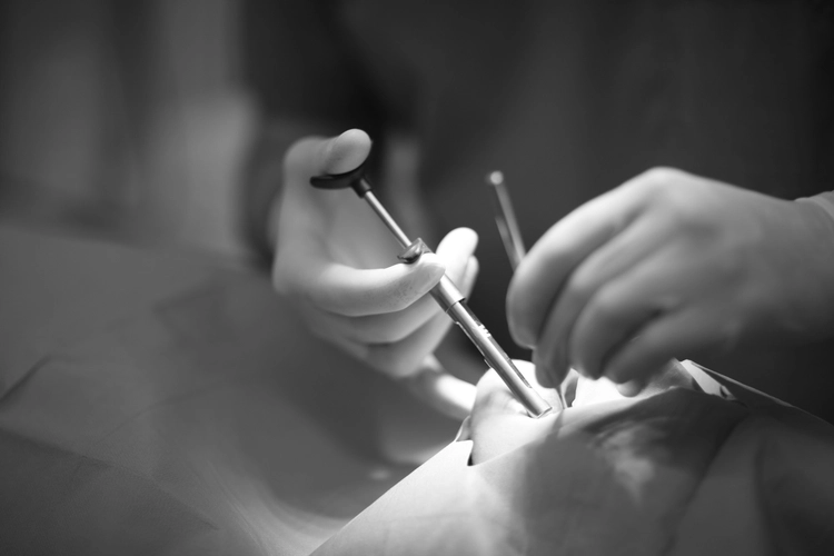 Синус-лифтинг | Стоматология в Томске | INTELLY | Эликсир Премьер