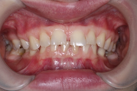 Результат работы(до)