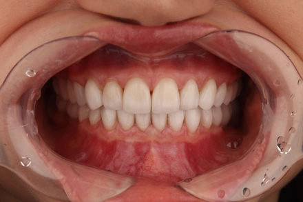 Результат работы(после)