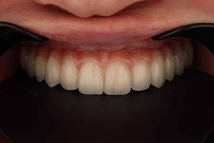 Результат работы(после)