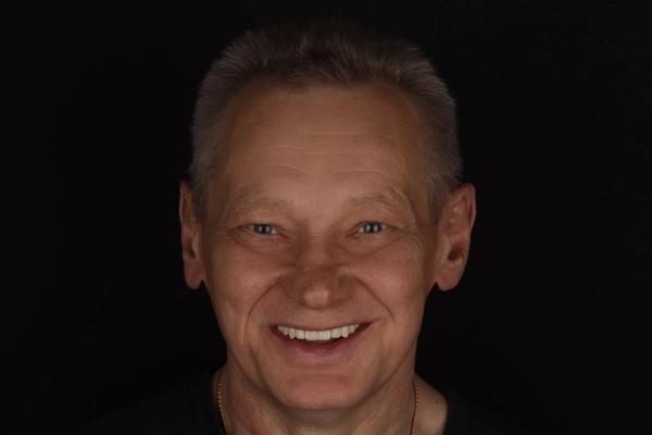 Пациент Олег | Стоматология в Томске | INTELLY | Эликсир Премьер