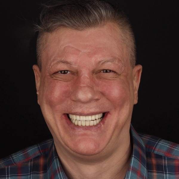 Пациент Станислав | Стоматология в Томске | INTELLY | Эликсир Премьер