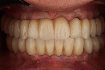 Результат работы(после)