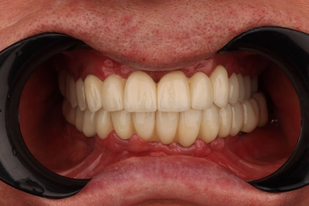 Результат работы(после)