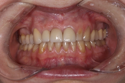 Результат работы(до)